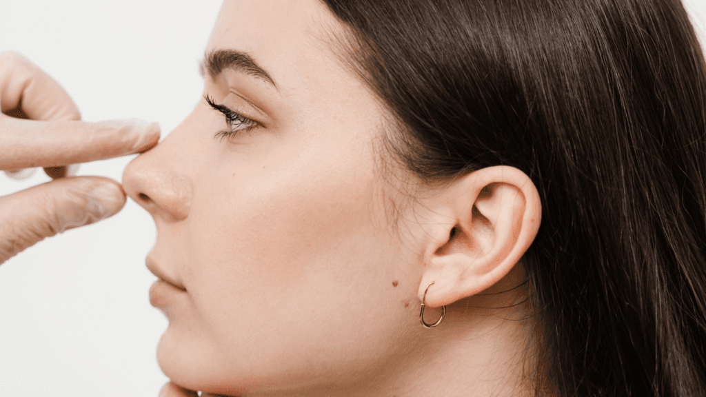Structural Rhinoplasty