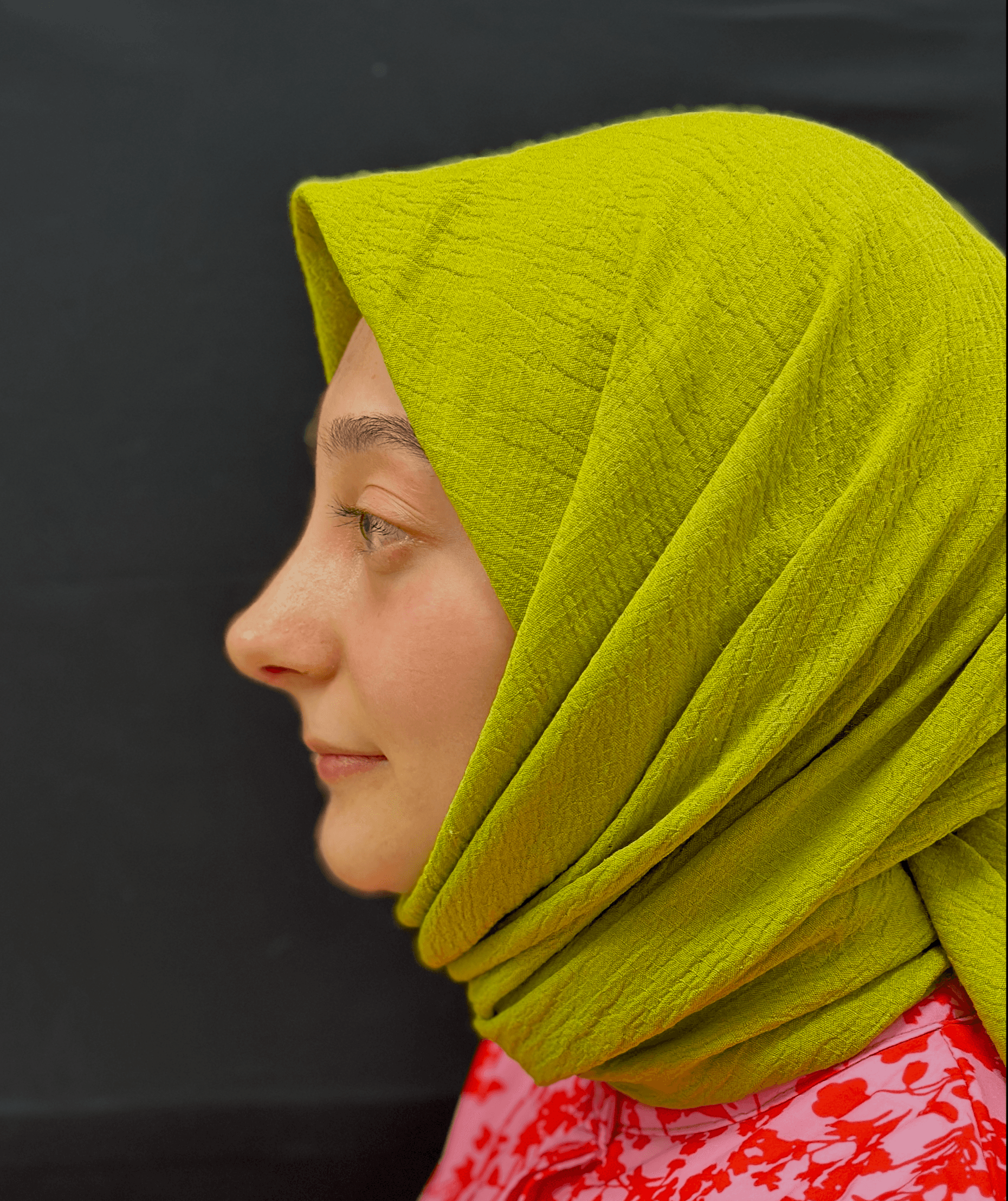 Ethnic Rhinoplasty Result 1 - After